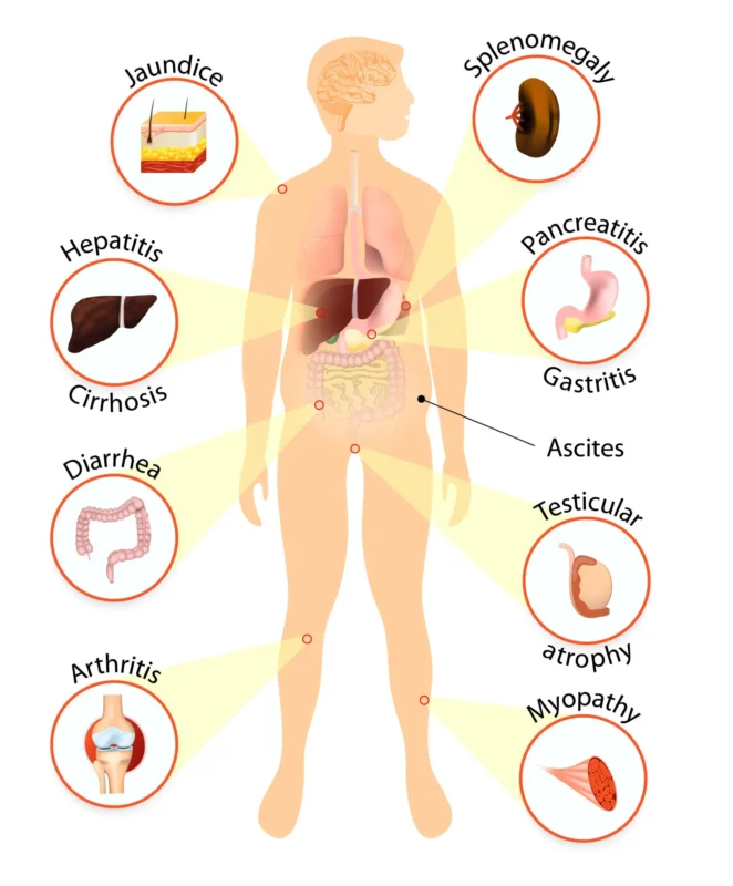 Liver Diseases