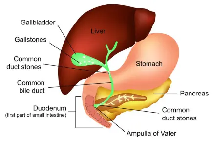Biliary Disease
