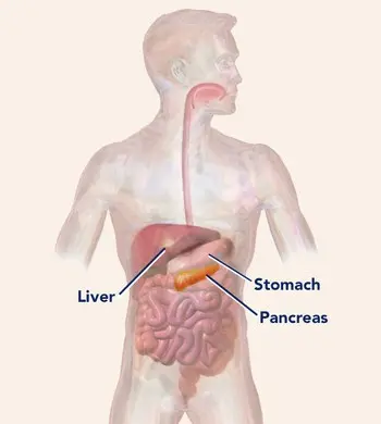 Pancreatitis