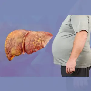 Fatty Liver Disease