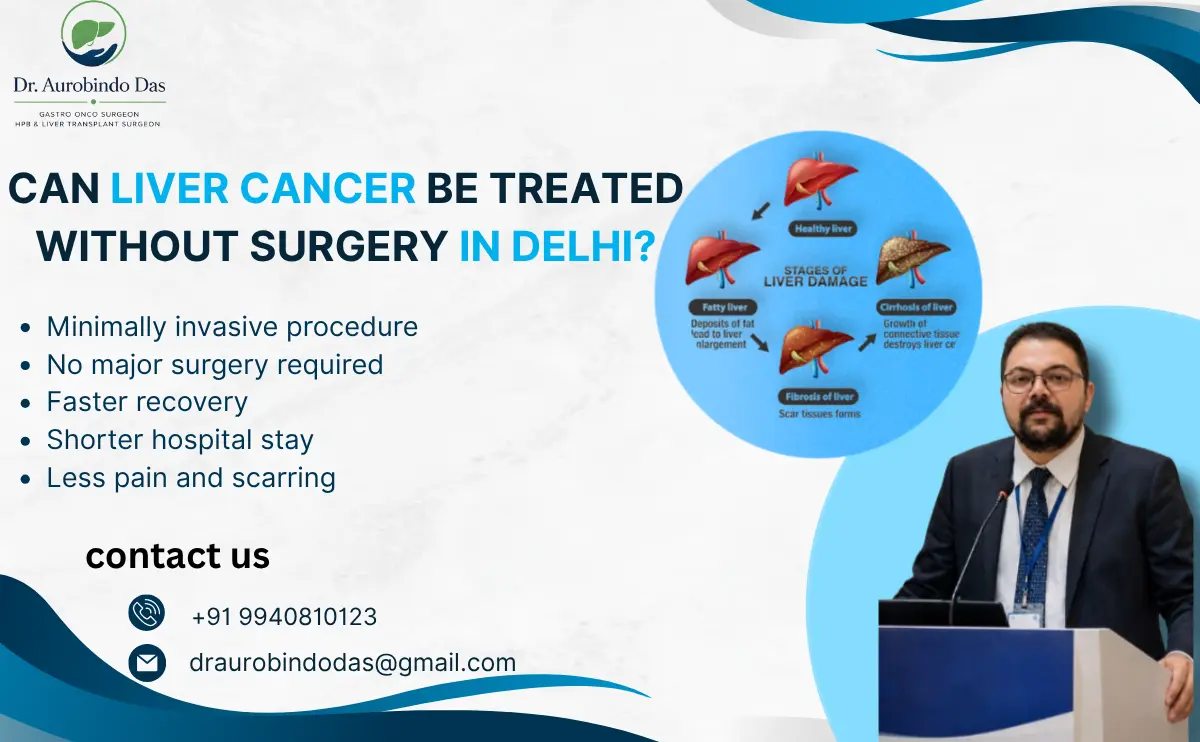 Liver Cancer Treatment Without Surgery Delhi