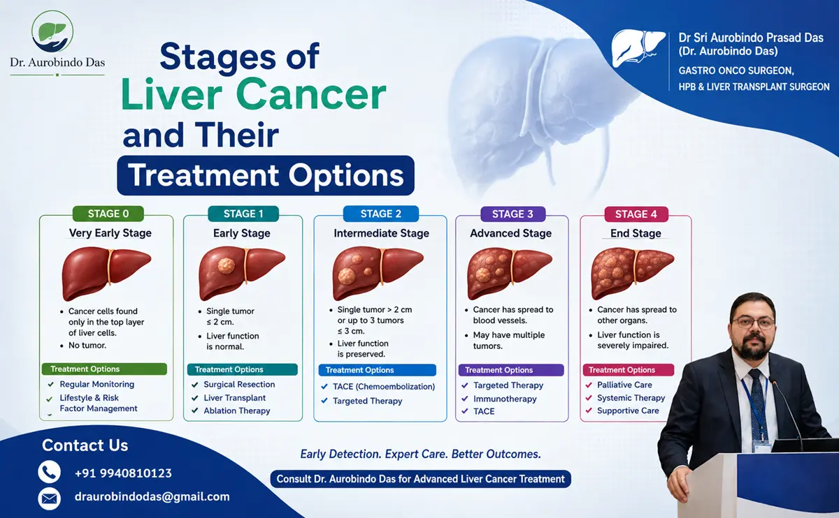 Liver Cancer Stages & Treatment Options