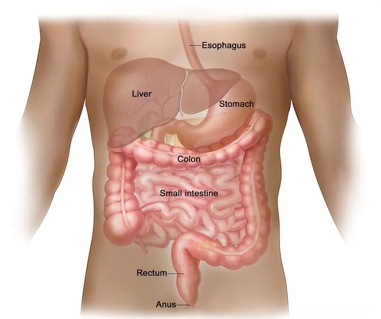 Colon Cancer