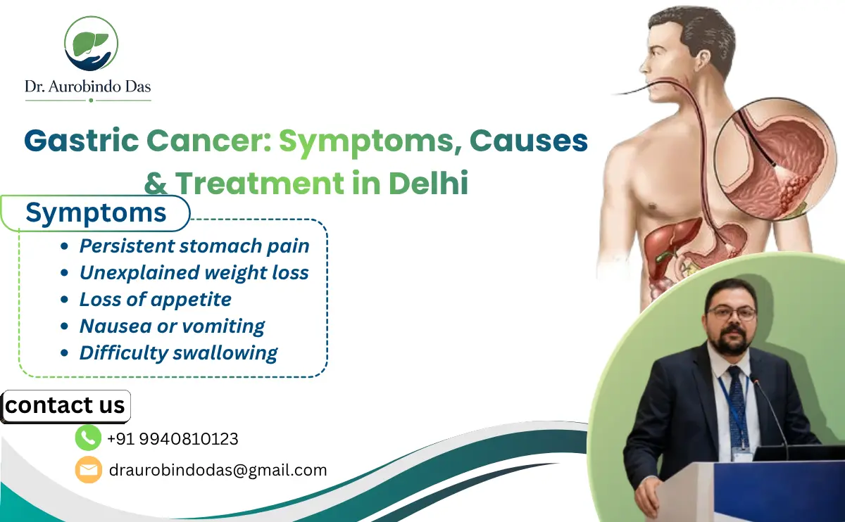 Gastric Cancer Treatment in Delhi